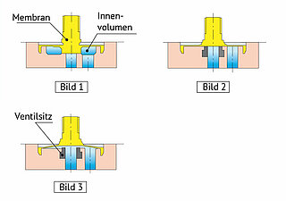 Innenvolumenoptimiert (Zero-Internal-Volume)